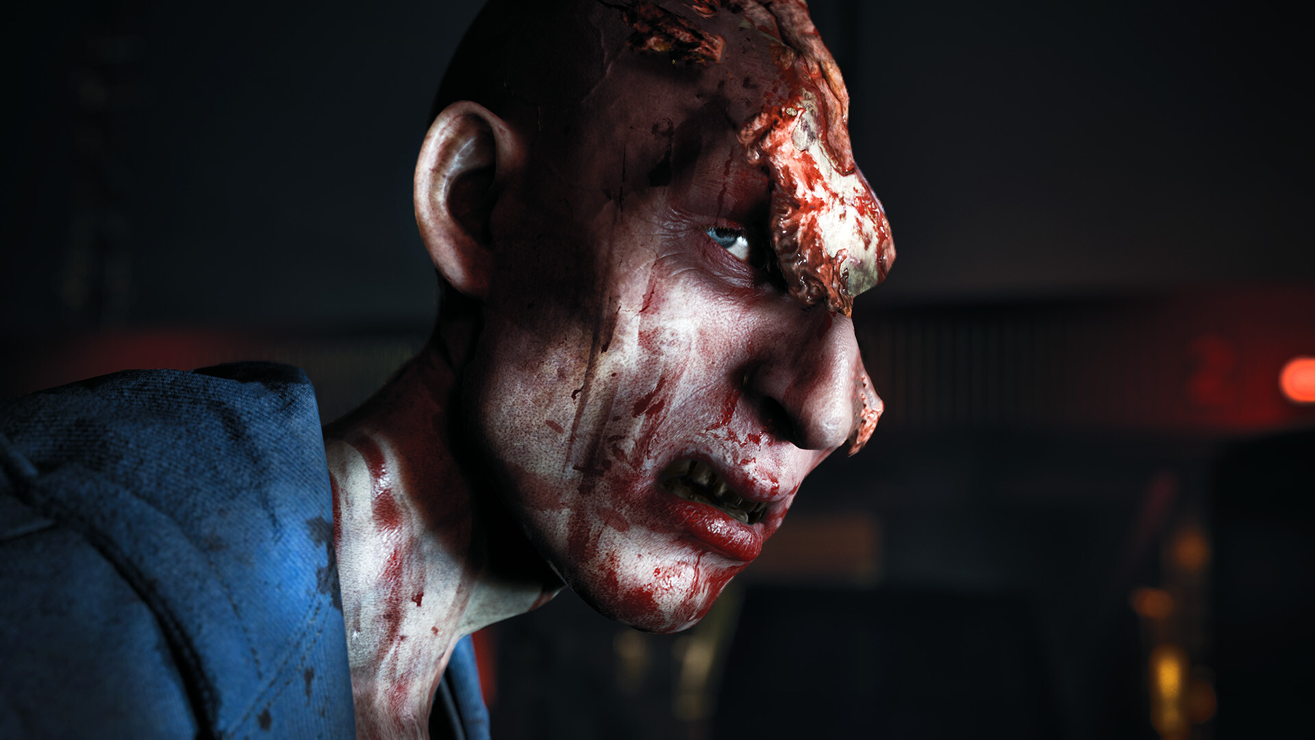 A survivor showing severe signs of infection